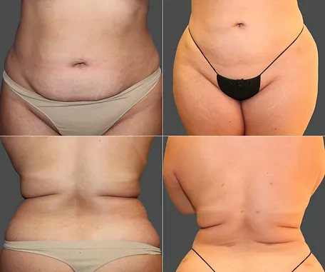 Before & After Gallery — before & after result